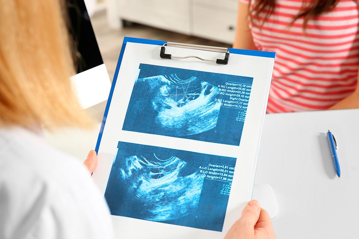 fertilidad-post-aborto